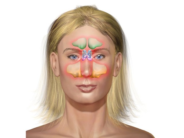 benh/ung-thu-xoang-329.html