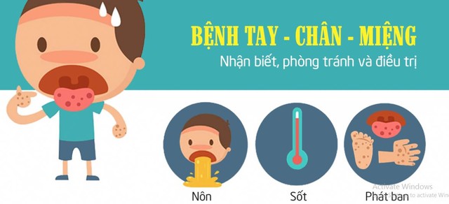 bai-viet/4-cap-do-cua-benh-tay-chan-mieng-va-cach-dieu-tri-hieu-qua-45649.html