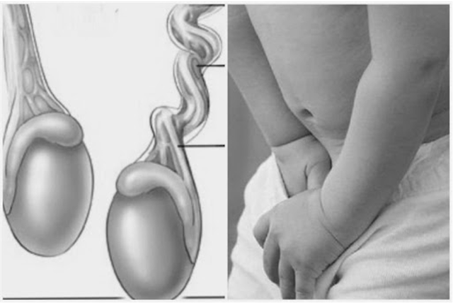 benh/xoan-tinh-hoan-510.html