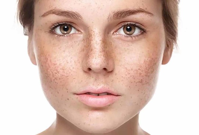 benh/ram-ma-531.html