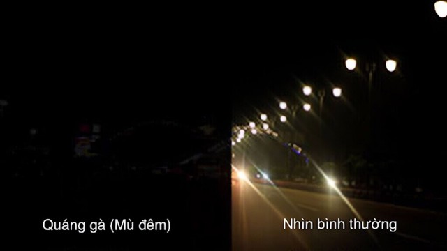 benh/quang-ga-551.html