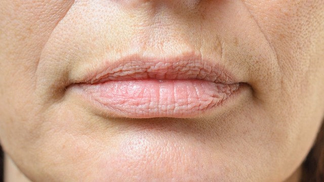 bai-viet/5-bi-quyet-xoa-mo-nep-nhan-quanh-khoe-mieng.html