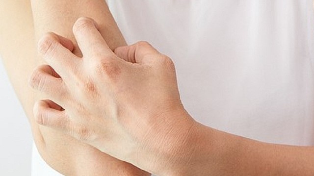 bai-viet/5-cach-lam-seo-loi-het-ngua-hieu-qua-54238.html