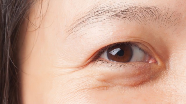 bai-viet/5-sai-lam-khi-duong-mat-lam-lo-ro-cac-nep-nhan-va-nhanh-lao-hoa.html