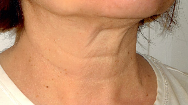 bai-viet/6-cach-lam-cham-qua-trinh-lao-hoa-da-vung-co-52486.html