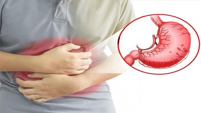 bai-viet/7-bai-thuoc-dan-gian-chua-viem-hang-vi-da-day-hieu-qua.html