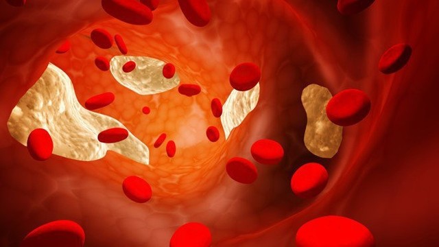 bai-viet/8-cach-giup-ban-giam-cholesterol-mau-62158.html