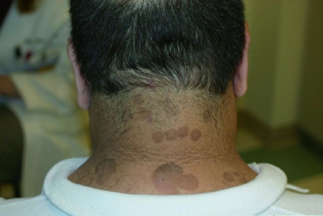 benh/lang-ben-982.html