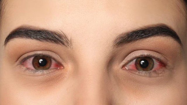 bai-viet/9-cach-phong-benh-dau-mat-do-hieu-qua-ai-cung-nen-biet.html