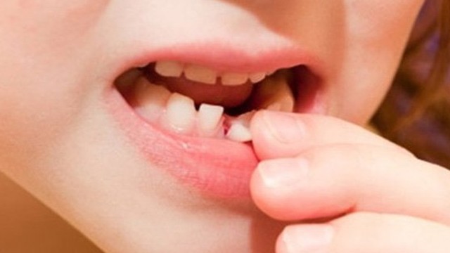 bai-viet/be-bi-nga-lung-lay-rang-sua-phu-huynh-nen-lam-gi.html