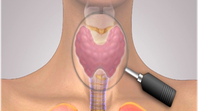 bai-viet/benh-nhan-tuyen-giap-la-gi-nguyen-nhan-va-cach-dieu-tri-nhan-tuyen-giap.html