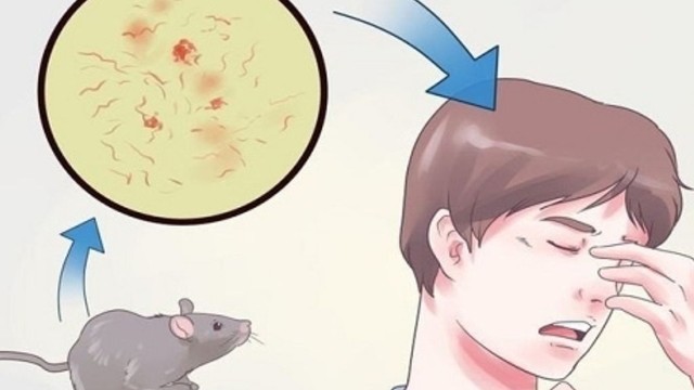 bai-viet/bi-chuot-can-co-nen-tiem-phong-dai-khong-cach-xu-tri-khi-bi-chuot-can.html