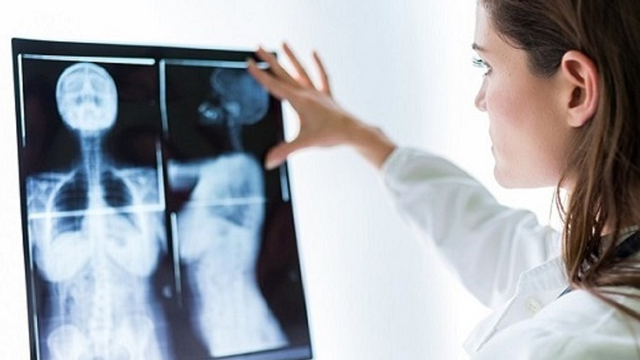 bai-viet/chup-x-quang-co-anh-huong-gi-khong.html