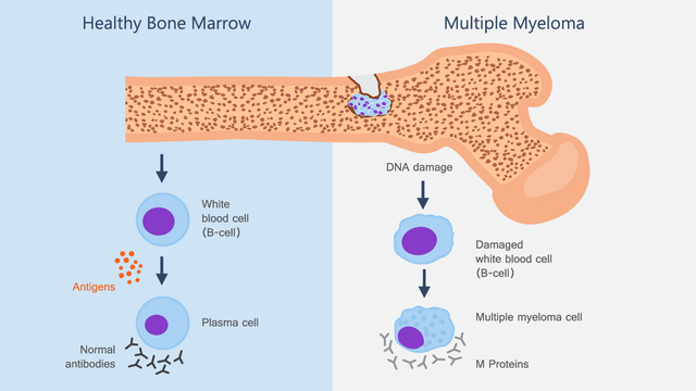 benh/da-u-tuy-xuong.html