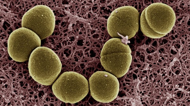 bai-viet/enterococcus-faecalis-vi-khuan-vua-co-loi-vua-co-hai-trong-co-the-nguoi.html