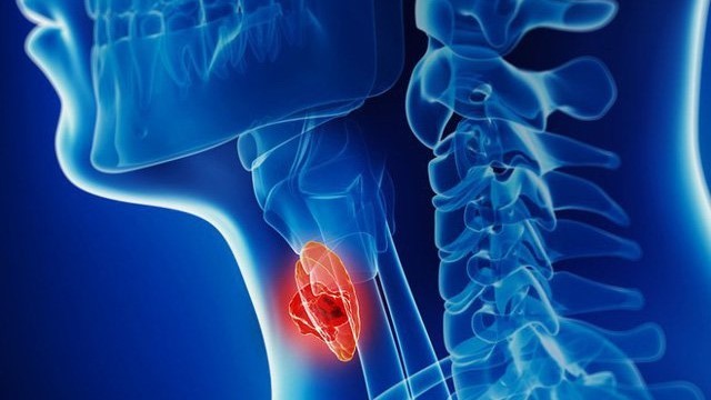 bai-viet/giai-dap-thac-mac-benh-ung-thu-ha-hong-giai-doan-4-song-duoc-bao-lau.html