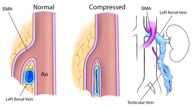benh/hoi-chung-kep-hat-de.html