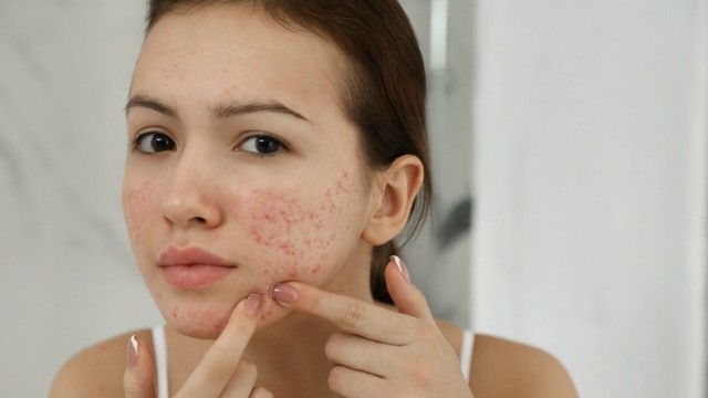 bai-viet/mun-do-o-ma-nguyen-nhan-va-cach-dieu-tri.html