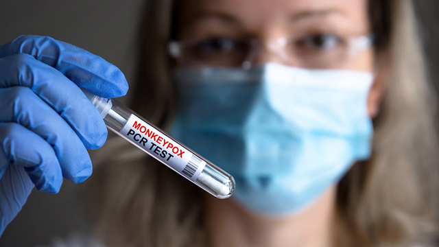 bai-viet/nguoi-truong-thanh-nen-tiem-dinh-ky-vacxin-dau-mua-khi-theo-khuyen-nghi-cua-cdc-my.html