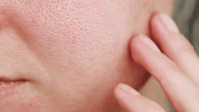 bai-viet/cach-cham-soc-de-lam-se-khit-lo-chan-long-mat-hieu-qua.html