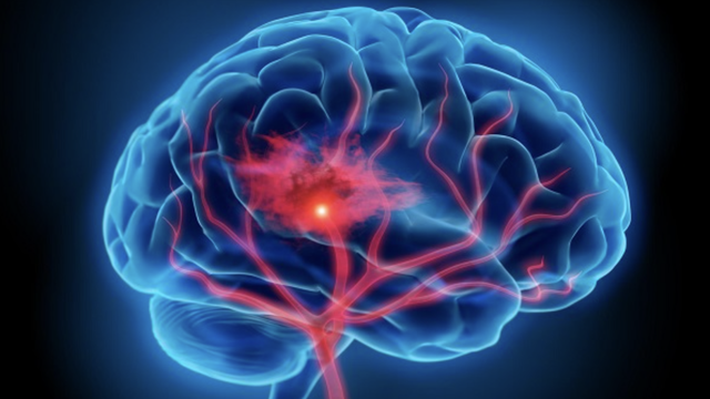 bai-viet/roi-loan-van-mach-nao-nguyen-nhan-va-cach-dieu-tri.html