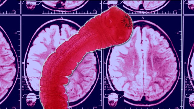 benh/san-day-lon.html