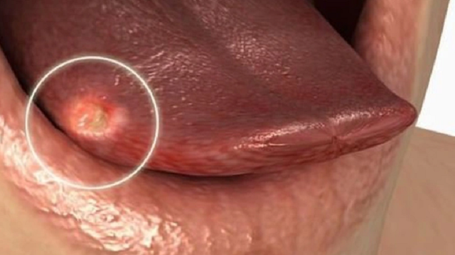 bai-viet/thong-tin-ve-buou-mau-o-luoi-tu-a-den-z.html