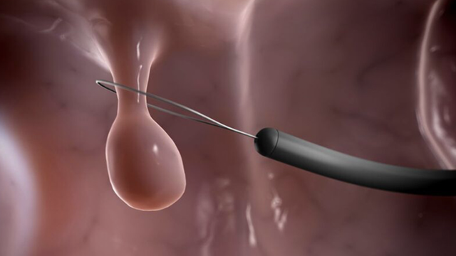 bai-viet/sinh-thiet-truc-trang-va-nhung-dieu-can-biet.html