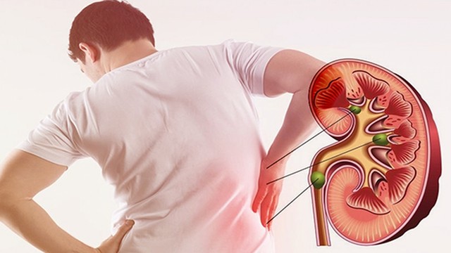 bai-viet/soi-than-la-gi-mot-so-yeu-to-nguy-co-gay-soi-than-co-the-ban-chua-biet.html