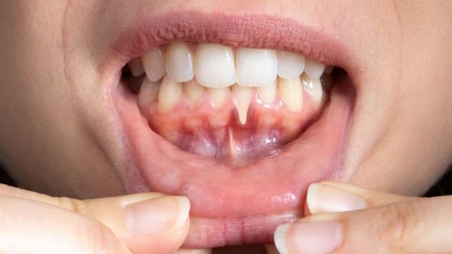 bai-viet/thuoc-boi-viem-loi-dung-nhu-the-nao-de-dap-ung-hieu-qua-nhanh-nhat.html