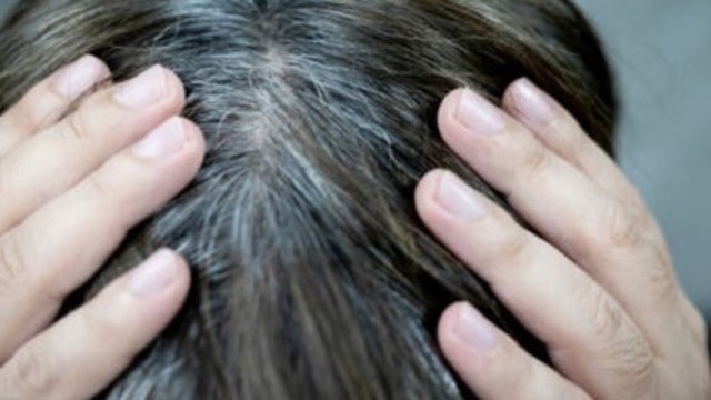 bai-viet/tim-hieu-nguyen-nhan-toc-bac-som-o-nam-gioi-va-cach-phong-ngua.html