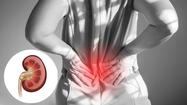 bai-viet/nhan-biet-cac-trieu-chung-soi-tiet-nieu.html