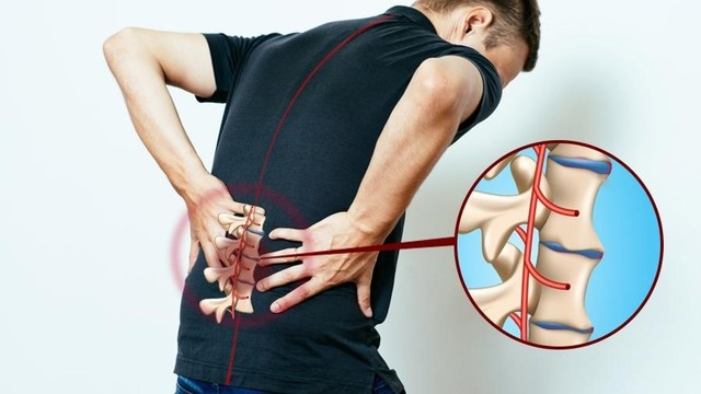 bai-viet/phac-do-dieu-tri-viem-cot-song-dinh-khop.html