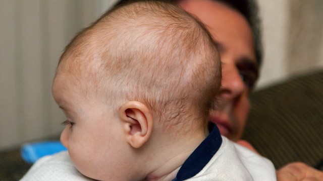 bai-viet/xuong-cham-nho-cao-o-tre-so-sinh-co-nguy-hiem-hay-khong.html