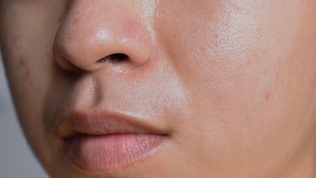 bai-viet/aha-bha-pha-la-gi-cong-dung-doi-voi-lan-da-va-cach-su-dung.html