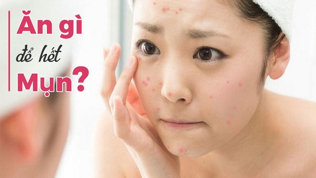 bai-viet/an-gi-de-het-mun-top-5-thuc-pham-vang-cho-lan-da-mun-66942.html