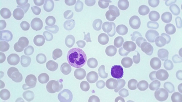 bai-viet/bach-cau-lympho-la-gi-dau-hieu-nhan-biet-bach-cau-lympho-tang.html