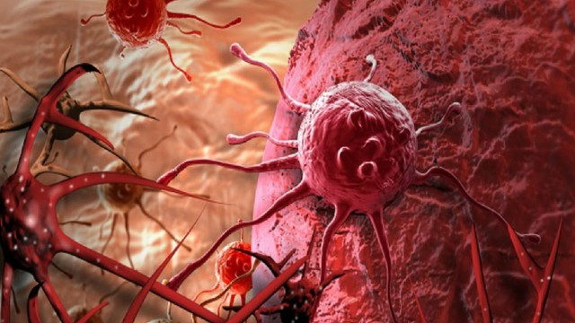 bai-viet/tong-hop-cac-bai-thuoc-chua-u-mau-trong-gan.html