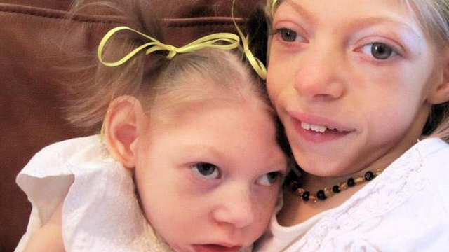 bai-viet/benh-batten-la-gi-nguyen-nhan-gay-benh-va-cach-dieu-tri-the-nao.html