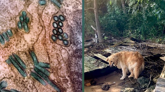 bai-viet/benh-dai-co-lay-qua-duong-mau-khong-cach-phong-tranh-lay-nhiem.html