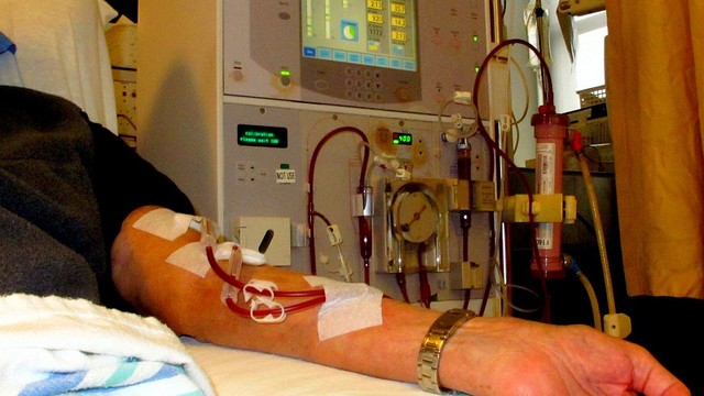 bai-viet/benh-nhan-chay-than-giai-doan-cuoi-song-duoc-bao-lau.html