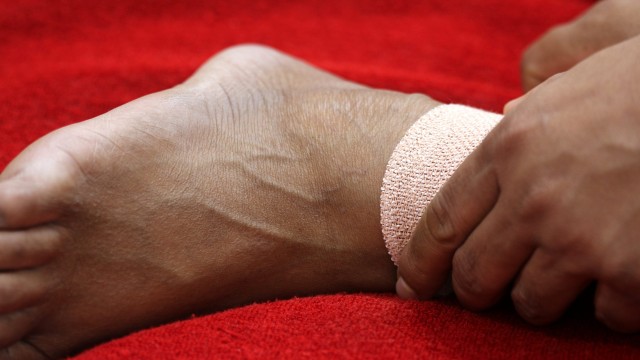 bai-viet/bi-cung-khop-co-chan-sau-phau-thuat-do-nguyen-nhan-gi.html