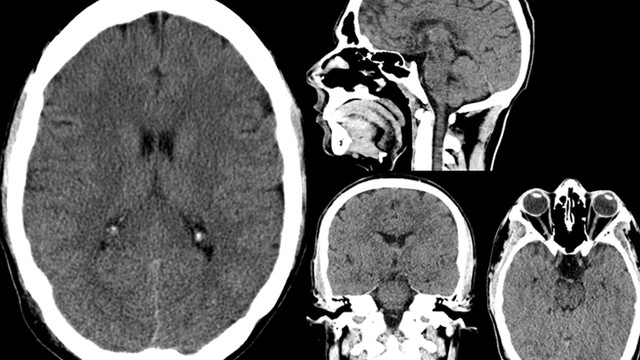 bai-viet/chup-ct-so-nao-duoc-thuc-hien-khi-nao-co-anh-huong-gi-khong.html