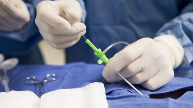 bai-viet/dot-viem-lo-tuyen-co-dau-khong.html