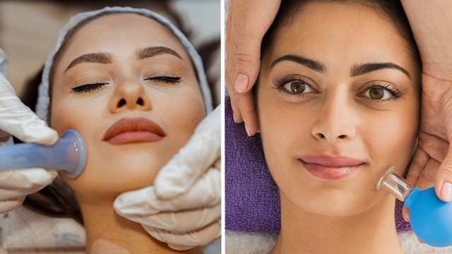 bai-viet/facial-cupping-la-gi-loi-ich-cua-facial-cupping-doi-voi-lan-da.html