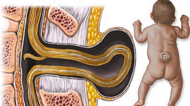 bai-viet/gai-doi-cot-song-s1-la-benh-gi-nguy-hiem-ra-sao.html