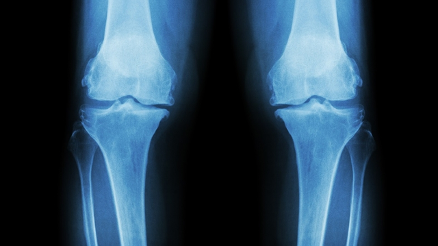 bai-viet/gay-sun-tang-truong-o-tre-em-nguyen-nhan-trieu-chung-chan-doan-dieu-tri.html