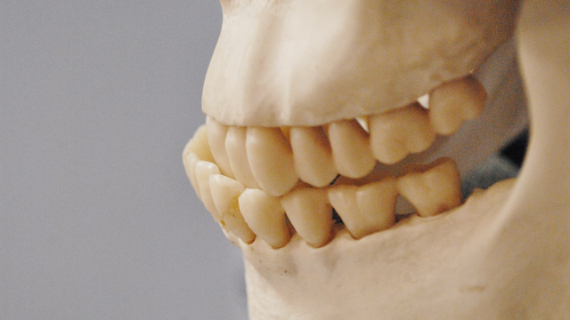 bai-viet/nhai-1-ben-bi-lech-mat-lam-sao-khac-phuc-hieu-qua.html