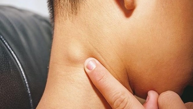 bai-viet/hach-bach-huyet-o-co-bi-sung-la-benh-gi.html