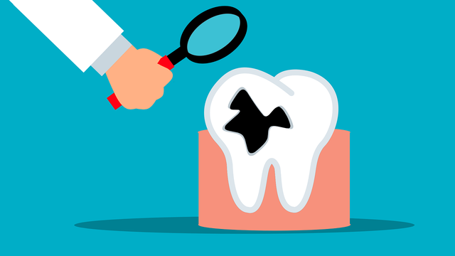 bai-viet/hoai-tu-tuy-rang-co-nguy-hiem-khong-dieu-tri-va-phong-ngua-ra-sao.html